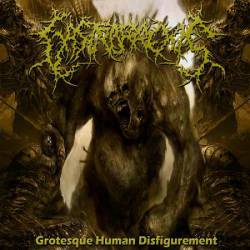 Gastrorrexis : Grotesque Human Disfigurement Gastrorrexis : Grotesque Human Disfigurement